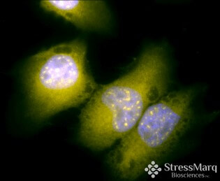 ICC of GRP78 Antibody in HeLa Cells