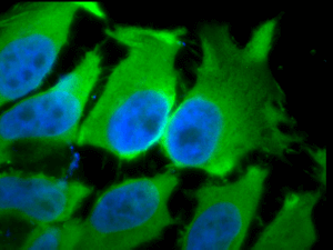 smc-151_hsc70-hsp73_antibody_1f2-h5_icc-if_human_heat-shocked-hela-cells_100x_merged