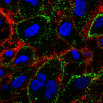 HSP70 Localization